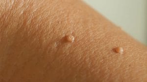 برداشت اسکین تگ