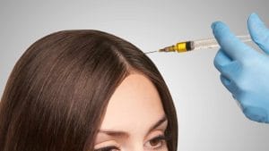 اگزوزوم تراپی مو