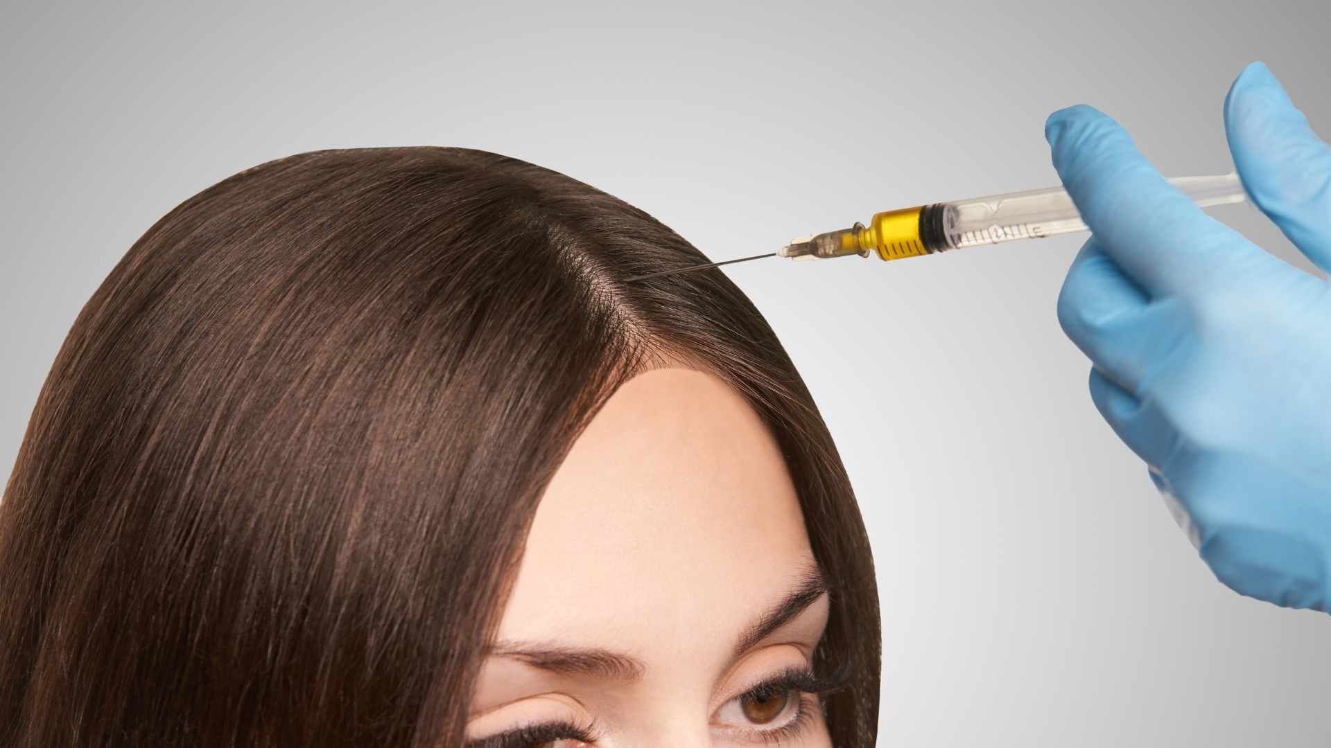 اگزوزوم تراپی مو