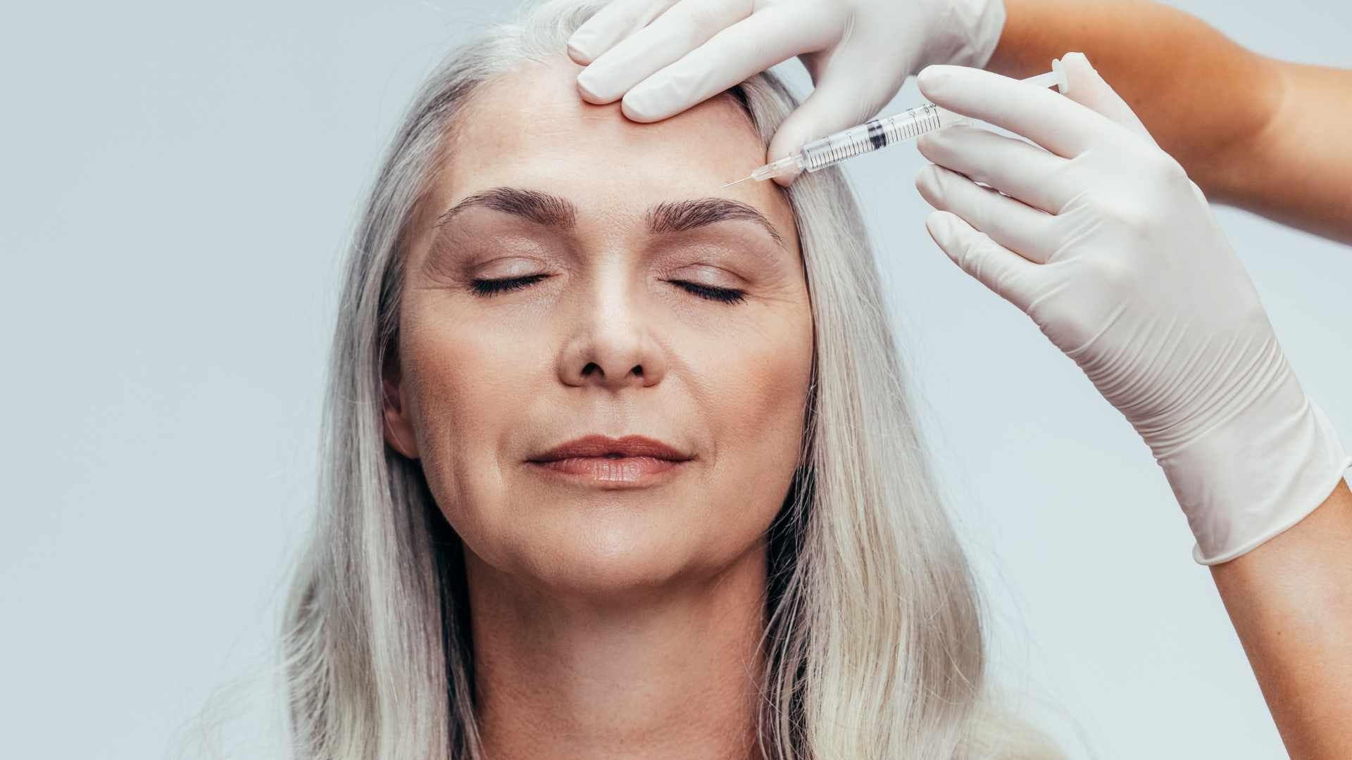 بوتاکس میگرن