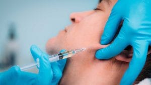 فیلر زاویه فک