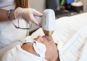 لیزر موهای زائد