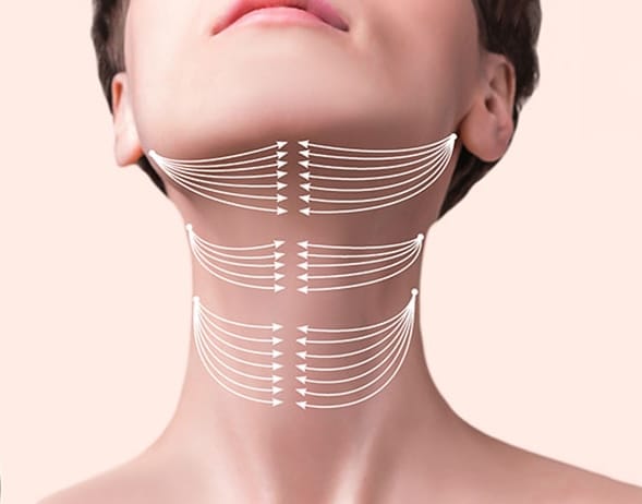 لیفت گردن با نخ