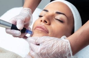 مزوتراپی صورت