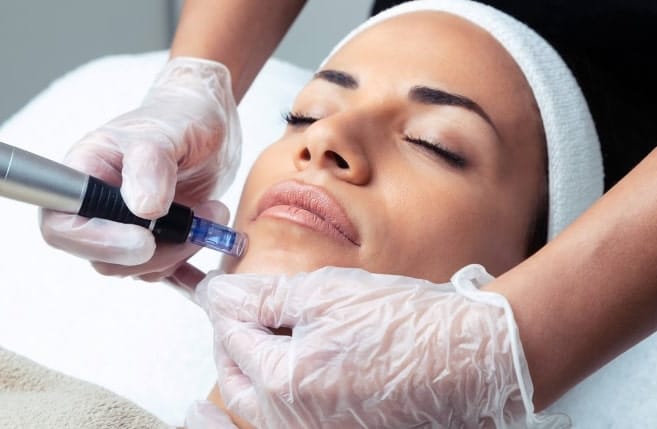 مزوتراپی صورت