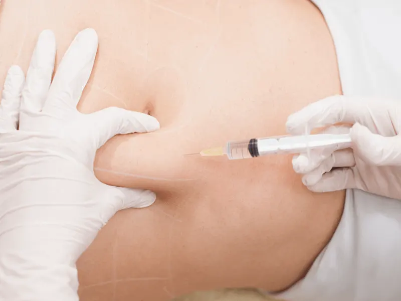 مزوتراپی لاغری