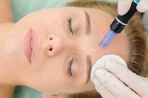 میکرونیدلینگ