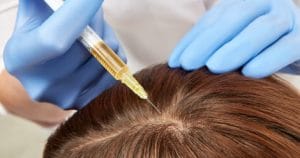 پی آر پی مو (PRP)